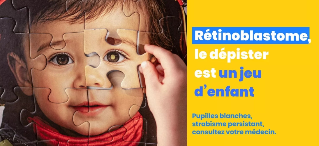 Rétinoblastome : mieux repérer le cancer de la rétine chez l’enfant